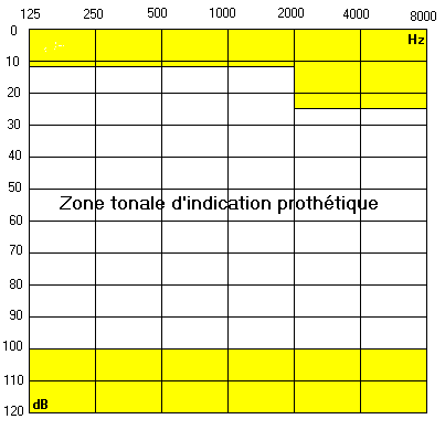 zone